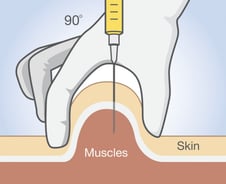 주사 맞은 부위 눌러야 할까, 문질러야 할까 [한 장으로 보는 건강]