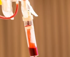 심장 판막 환자, 수혈량 많을수록 사망·뇌졸중 위험 최대 3배↑