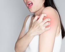 "빈대 물린 줄" 갑자기 가려워서 '벅벅'…이 질환 때문이었다