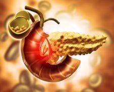 등·어깨 아파 병원 갔더니 '수술불가' 췌장암?…이런 사람들 '위험'