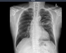 뷰노, 우즈베키스탄 군 병원 5곳에 의료 AI 솔루션 공급