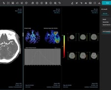 제이엘케이, 북미영상의학회서 '뇌경색 AI 솔루션 ' 임상 결과 발표