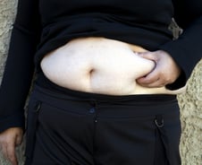 "똑같이 먹는데 왜 찔까?" 40대女 고민…"문제는 이것" 한의사 조언