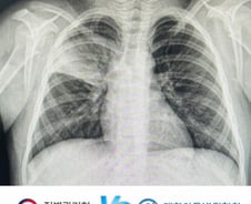 '이 폐렴' 걸린 아이들 급증에도…질병청 데이터에 '아동병원' 빠진 이유