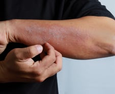 난방 틀었더니 밤새 '벅벅'…아이들 병인 줄 알았는데 2040 환자 '급증'