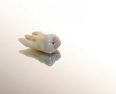 겨우 치아 때문에 전신마취·수술?…사랑니 놔둬도 괜찮을까