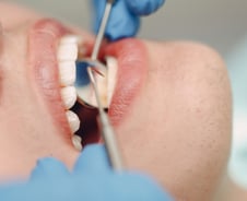 수면 내시경은 되는데 수면 임플란트는 안 된다?