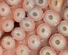 문어 빨판만 봐도 식은땀 '줄줄'…환 공포증 극복할 수 있을까?