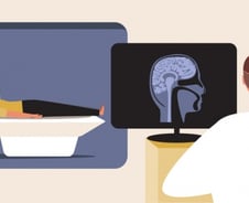 머리 부딪혔을 때 CT와 MRI 중 뭐 찍어야 할까[한 장으로 보는 건강]