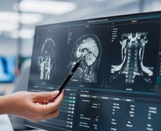 매년 수 천건 시행 '뇌 감압' 치료…감염률 10% 낮춘 '새 프로토콜' 개발