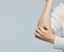 "으악, 간지러워" 겨울철 피부 긁는 여성…알고 보니 갱년기 때문?