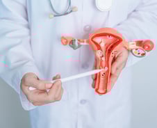 유전성 자궁내막암 위험, 高비용 유전자 검사 전 '이것'으로 선별