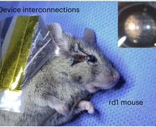 "실명한 쥐가 시력 되찾아" 말랑한 '인공망막' 국내 개발…상용화는