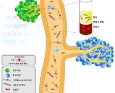 재발 예측 관건인 난소암… "혈액 속 암 조각 유전자 찾아 빠르게 진단"