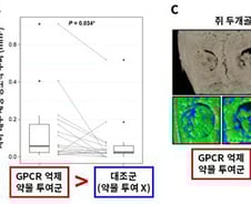 "부러진 뼈·치아에 '이것' 넣으니 되살아나" 새 재생 유도 기전 찾았다
