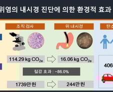 병원도 지구온난화 원인? "조직검사 말고 내시경, 탄소 배출 86%↓"