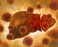 "지방간 흔한데 뭔 걱정" 넘겼는데…'침묵의 장기'가 보낸 마지막 신호