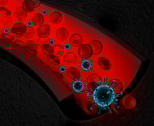 세균 감염 확인하는 '프로칼시토닌 검사' 폐렴 입원 환자에 급여 확대