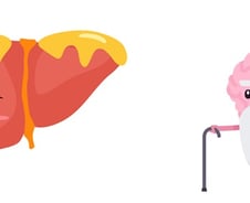 비알코올 지방간 있는 어르신…'치매' 걱정해야 하는 이유