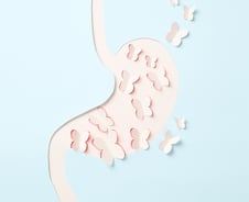 위 선종 떼도 9%는 암 발병…'이 치료' 받자 발병률 20% 낮아졌다