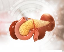 "술 때문이겠지" 배 아파도 가볍게 넘겼는데…췌장암 부르는 이 병?