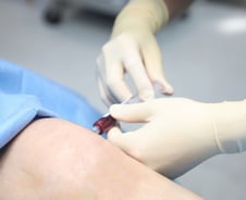 무릎 관절염 끝판왕? 사실은…'줄기세포 주사' 허와 실