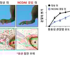 "출산 버금가는 고통" 통풍 유발 단백질, 韓의료진이 세계 최초 규명