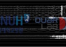 "사람 판독 결과와 80% 이상 일치"…수면 단계 나누는 AI, 한국서 개발