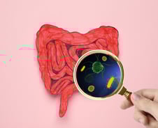운전 중 "또 배 아파" 괴로운 과민성장증후군…'이것' 먹으면 "편안하네"