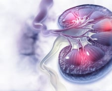 소변 색 변할 땐 늦었다…"몸 붓고 피곤해" 더 빨리 병원 가야 할 사람은
