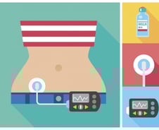 2형 당뇨병 환자, 인슐린펌프에 '이것' 추가했더니 인슐린 사용량 더 줄어