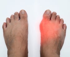 중년 남성에 '출산의 고통'과 같은 통증…"이 병 걸리면 평생 약 먹어야"