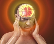 "뇌경색 환자 63%는 골든타임 놓쳐"…10년 동안 달라진 게 없었다