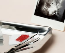 초음파 68회에도 암 못 찾은 한의사 '무죄'…양·한방, 날 세운 이유