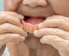 틀니도 수명이 있다…'이때'는 병원 꼭 가야