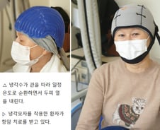 항암치료와 뗄 수 없는 탈모…'이 모자'가 막았다