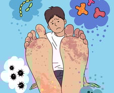 긁기도 민망한 '사타구니' 가려움…발 무좀 때문이라고?[한 장으로 보는 건강]