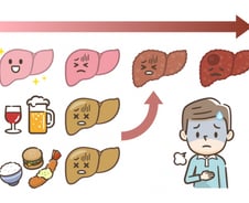 술도 안 마시는데 찾아온 지방간…○○○암 위험 '4.7배'