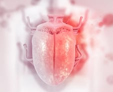 "혀 절반 절제할 수도"…구내염인 줄 알았더니 '이 암'