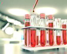 서울대병원, 세계에서 가장 빠른 '패혈증 검사 기술' 개발