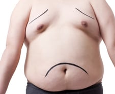 "왜 이렇게 몸이 무겁지" 10kg 훅 쪘다…동시 복용한 '이 약' 때문