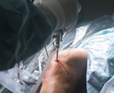 내 무릎 핀 박은 사람이 영업사원?…'한달 150건' 대리수술 병원 재판행