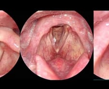 술 마시며 담배 한 모금 '뽁'… 머리·목에 장애 유발하는 '이 암'