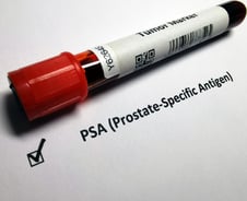 "일본처럼 '남성암' 1위 머잖았다…중년부터는 매년 '이 검사' 받아야"