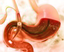 담도에 내시경 검사, 무엇이 좋나? 국내 연구진 세계 첫 '비교 연구' 발표