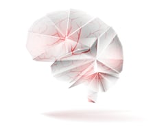 "치매 원인" 나이따라 달라…65세 이상, 뇌 독성물질보다 '이것' 더 중요