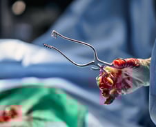 '아시아 최초'로 성공하더니 또 일냈다…80대 환자 살린 '최고난도 시술'