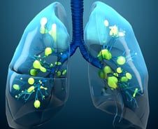 입원 위험 73% 줄였다…겨울 오기 전 성인도 챙겨야 할 '이 백신'