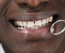 어쩐지 음식물 잘 끼더라…난데없는 '삼각형 구멍'이 보낸 신호[한 장으로 보는 건강]