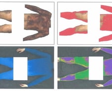 한국산 '파란 쫄쫄이' 입었더니 통증 원인을 콕…미·중서 특허등록